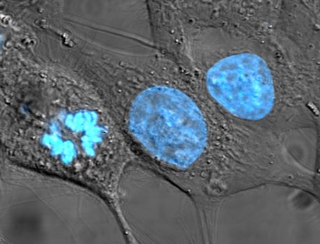 HeLa_cells_stained_with_Hoechst_33258.jpg.webp