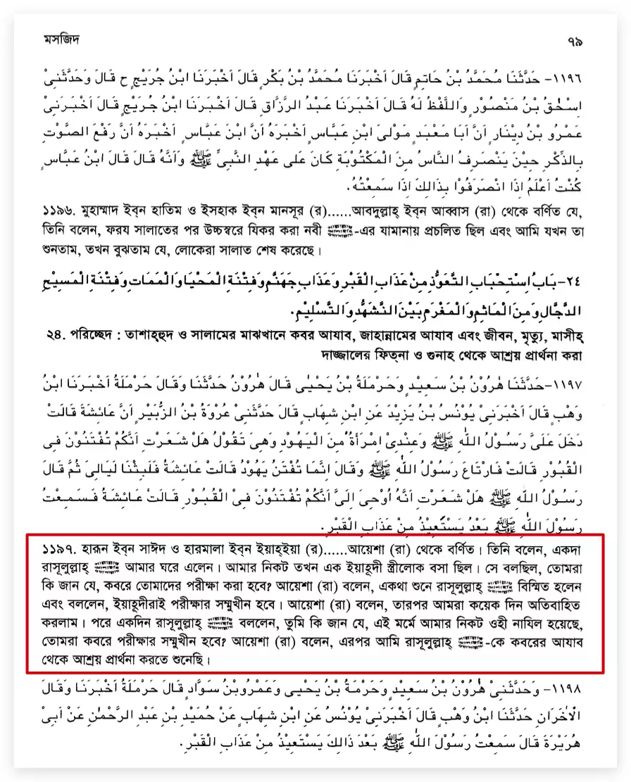 কবরের আজাব সম্পর্কে বিস্ময়
